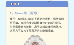 正畸横腭杆什么时候需要佩戴？最佳时机如何判断？