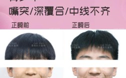 西安整牙齿矫正，如何选择靠谱医院？