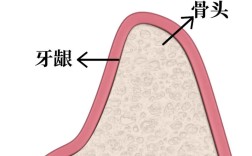 牙槽骨最少高度种牙