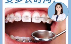 临时冠正畸究竟能戴多久？不同正畸阶段佩戴时间有何差异？需结合哪些因素调整期限？