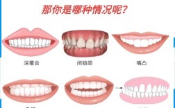 隐形牙套有多少种？不同品牌各有哪些类型？