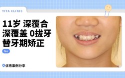 广州矫正牙齿哪里好？求推荐靠谱机构或医生？