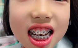 矫正牙齿为啥要拍照片？这些照片有啥关键作用？