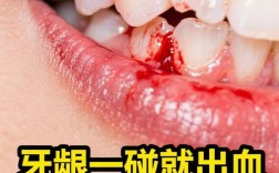 矫正牙齿牙龈出血，是正常现象吗？