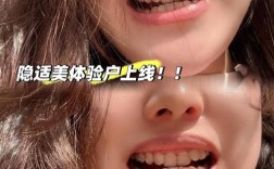 潍坊可恩口腔正畸效果如何？值得信赖吗？