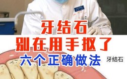 如何有效去除牙石？不同方法的效果和安全性如何？