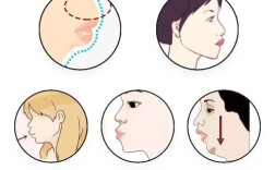 矫正牙齿能改变凸嘴吗？效果如何？