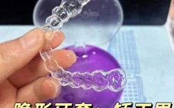 姑苏隐形矫正牙齿效果如何？值得尝试吗？