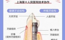 种植牙与真牙有何本质区别？功能与寿命是否相同？