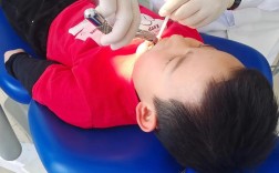 儿童6龄齿拔除正畸