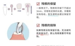种植牙失败后如何处理？原因分析、应对策略与修复全攻略指南