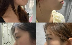 矫正牙齿后侧脸变好看？这背后有什么原因？