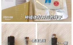 判断种植钉松动方法