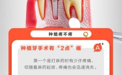 种牙手术痛苦吗