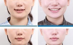 广州矫正牙齿哪里好？怎么选靠谱机构？