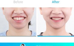 广州牙齿快速正畸