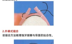 口内缝合打结如何规范操作？方法与技巧详解