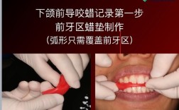 正畸关闭间隙的挂法具体指哪些技术？相关图片如何直观展示操作步骤与要点？