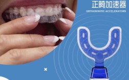 美速达正畸加速器价格是多少？