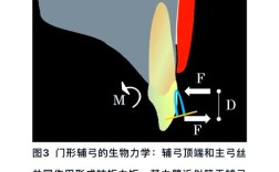 正畸门型辅弓图片