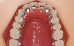 绍兴牙齿矫正去哪好？专业机构怎么选？