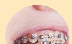 白博士牙齿矫正效果如何？靠谱吗？