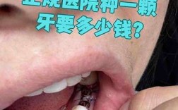 常州102医院种牙好不好？真实体验如何？
