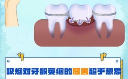 种牙不能抽烟嘛