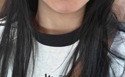 21岁拔牙矫正牙齿