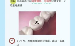 有十颗龋齿能做正畸吗