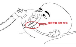 下颌铰链轴固定方法如何选择与操作以保障稳定性？