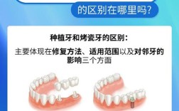 烤瓷牙和种牙，哪种牙齿修复方式更适合你？