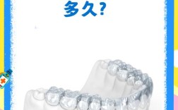 正畸 保持器 好