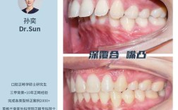 口腔颌面外科能正畸吗？