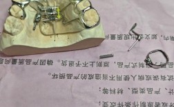 做正畸推簧的步骤