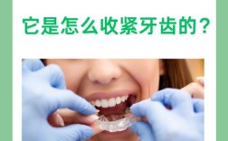 如何正确佩戴牙套？新手必学步骤与注意事项