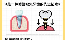 什么是种牙修复