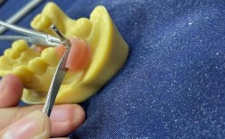 成都华西口腔种牙靠谱吗？效果和价格如何？