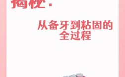 烤瓷牙制作方法图解，从备牙到戴牙的完整制作步骤图解是怎样的？