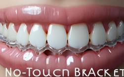 2025年无拖槽隐形矫正，真能实现隐形又高效？