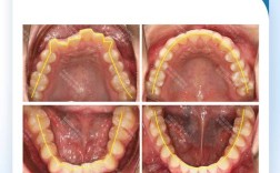 呼市矫正牙齿哪里好？专业机构怎么选？口碑靠谱吗？