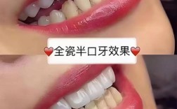 美国美白牙齿方法有哪些？主流方式有何不同？