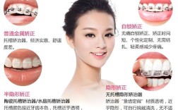 牙齿正畸最快的方法究竟是什么？安全性和效果如何，是否适合所有人群？