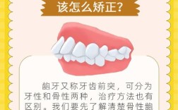 龅牙矫正有最快方法吗？哪种见效最迅速？