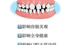 牙齿稀疏怎么办？有效改善方法有哪些？