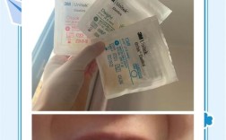 牙正畸皮筋舌头磨破