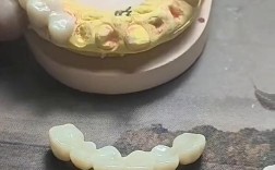 烤瓷牙备牙方法