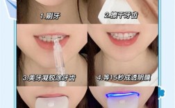 牙科牙齿美白方法，哪种安全有效且持久？