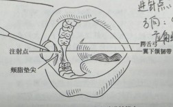 拔牙常用局麻方法有哪些？如何确保麻醉效果与安全？