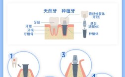 种牙系统哪个好